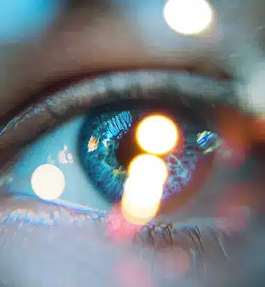 ICL: A close-up shot of a blue eye with several lens flares obscuring it.