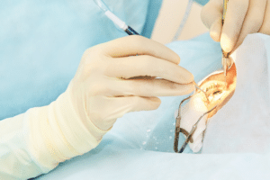 Individual in surgical attire with scissors demonstrating LASIK Safety.